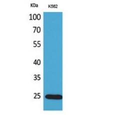 Anti-IGFBP6 antibody