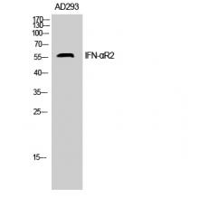 Anti-IFN-αR2 antibody