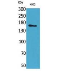 Anti-Laminin γ-2 antibody