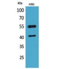 Anti-IL-2Rγ antibody