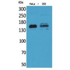 Anti-CD148 antibody