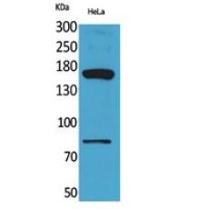 Anti-CD163b antibody