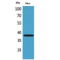 Anti-CD158b2/j antibody