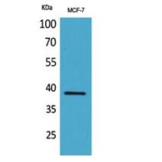 Anti-Cerberus antibody