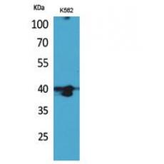 Anti-GPR87/95 antibody