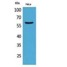 Anti-FMO3 antibody