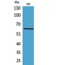 Anti-IL-18R antibody