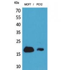 Anti-CD225 antibody