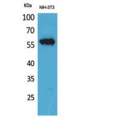 Anti-CD223 antibody