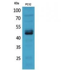 Anti-NKp44 antibody