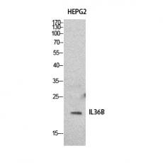 Anti-IL-1F8 antibody
