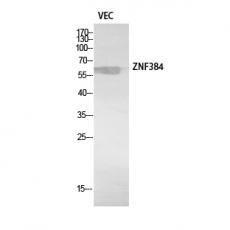 Anti-ZNF384 antibody