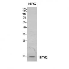 Anti-IFITM2 antibody