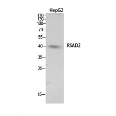 Anti-RSAD2 antibody