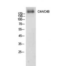 Anti-C4a/b antibody