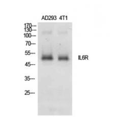 Anti-IL-6Rα antibody
