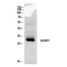 Anti-IGFBP1 antibody