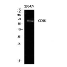 Anti-CD96 antibody
