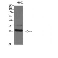 Anti-Tryptase-3 antibody