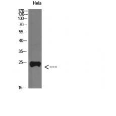 Anti-PTH-rP antibody