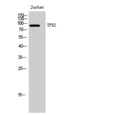 Anti-TPX2 antibody