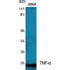 Anti-TNF-α antibody