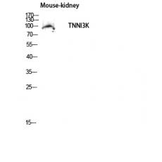 Anti-TNNI3K antibody