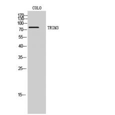 Anti-TRIM3 antibody