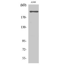Anti-T-type Ca++ CP α1H antibody