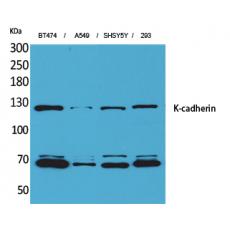 Anti-K-cadherin antibody