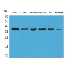 Anti-RRP7A antibody