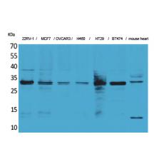 Anti-Latexin antibody