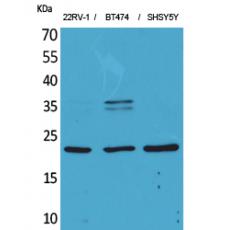 Anti-FGF-12 antibody