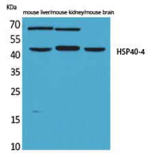 Anti-HSP40-4 antibody