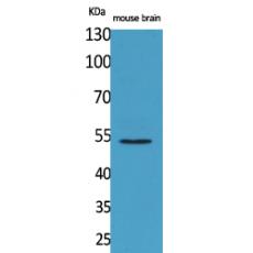 Anti-CPE antibody