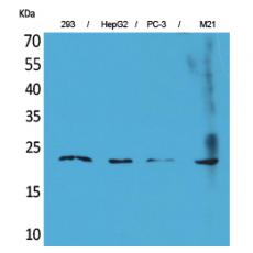 Anti-FGF-6 antibody