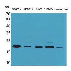 Anti-FGF-20 antibody
