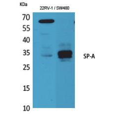 Anti-SP-A antibody