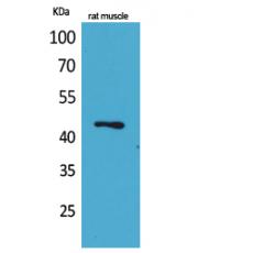 Anti-KLF12 antibody
