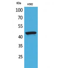 Anti-P2X3 antibody