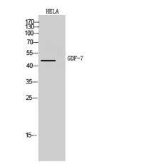 Anti-GDF-7 antibody