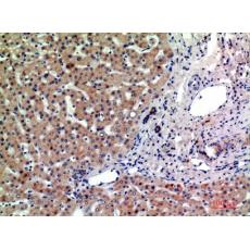 Anti-CD315 antibody