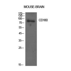 Anti-CD180 antibody