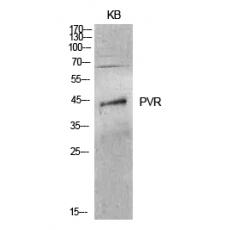 Anti-CD155 antibody