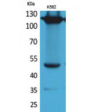 Anti-Integrin α4 antibody