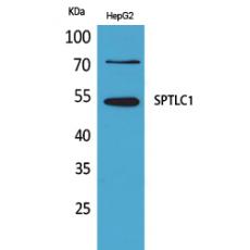 Anti-SPTLC1 antibody