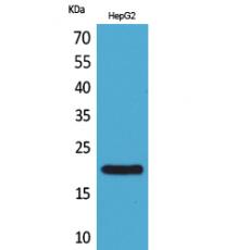 Anti-VHR antibody