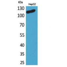 Anti-DPYD antibody
