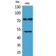 Anti-HDC antibody