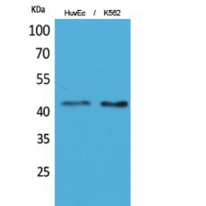 Anti-Layilin antibody